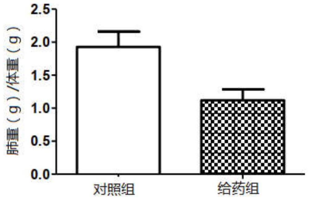 一種抗IL-11單克隆抗體的藥物制劑的制作方法