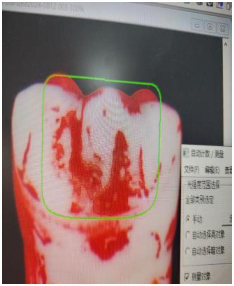 一种基于VISIA技术模拟测试刷牙去牙菌斑效果的方法与流程