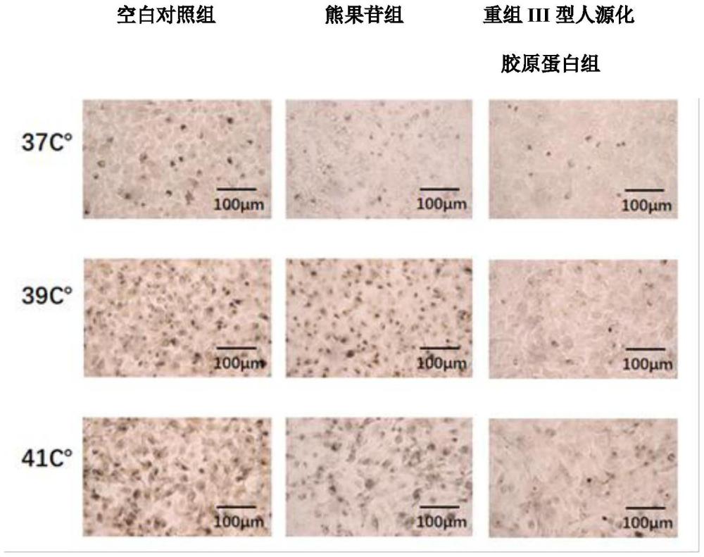 重組III型人源化膠原蛋白在熱誘導(dǎo)黑色素生成和角質(zhì)生成細(xì)胞遷移能力下降中的應(yīng)用的制作方法