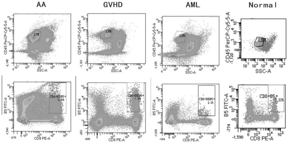 CD45+ CD8+ HLA-DRB5+ T細(xì)胞在制備輔助診斷再生障礙性貧血和移植物抗宿主病的試劑盒中的應(yīng)用