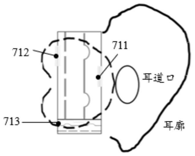 一種聲學輸出裝置的制作方法