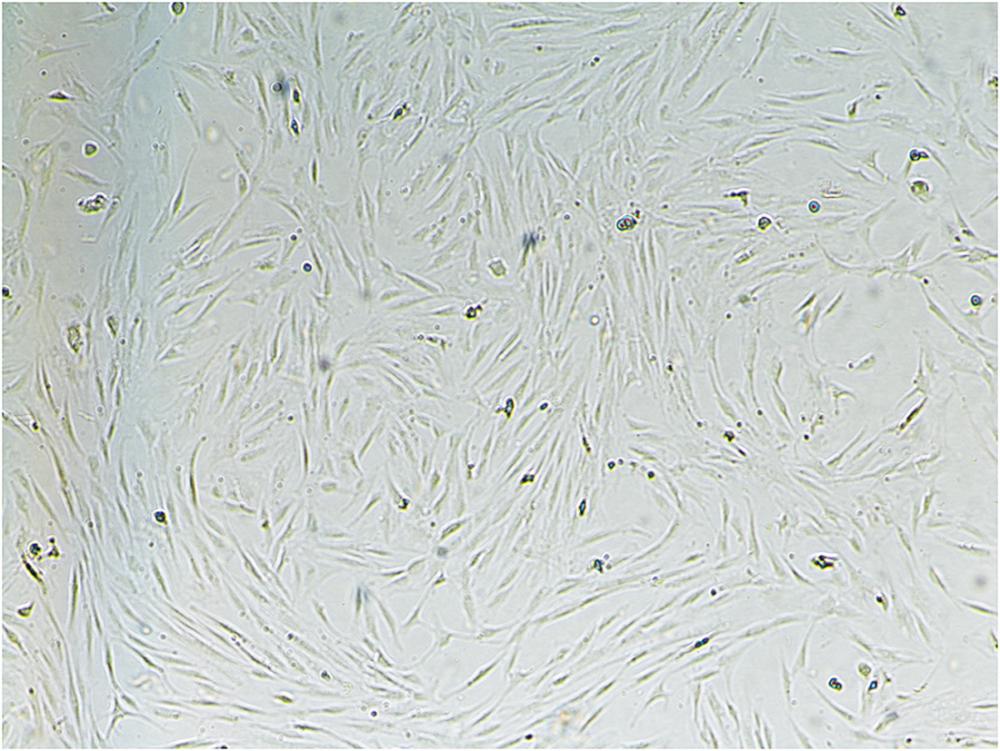 一種新的原代乳腺癌腫瘤相關(guān)成纖維細(xì)胞的提取方法