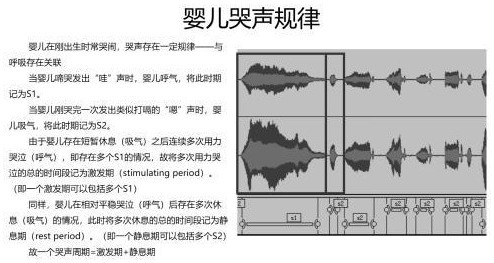 一種嬰兒哭聲特征提取方法