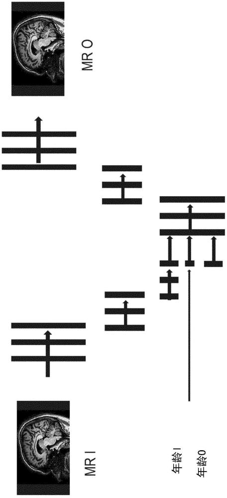 圖像處理設(shè)備和方法與流程