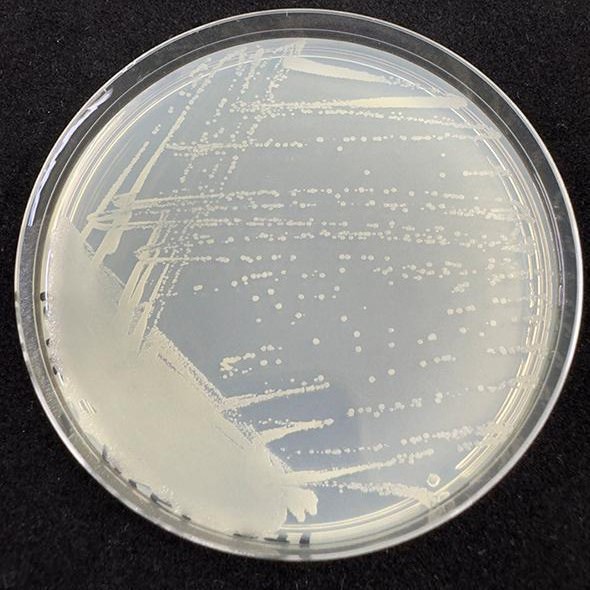 貝萊斯芽孢桿菌MSGL-ZJ1及其應(yīng)用和微生物制劑的制作方法