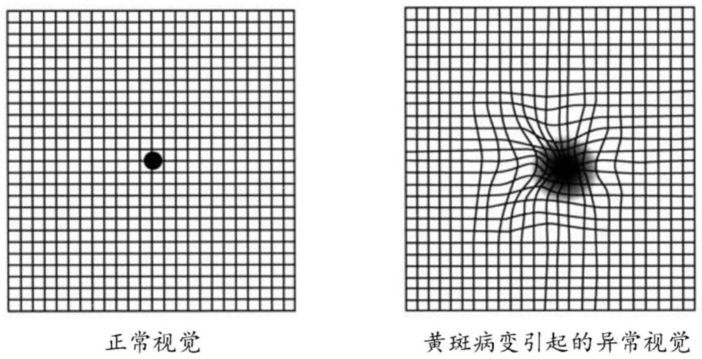 確定視物扭曲量的方法和裝置及存儲介質(zhì)與流程