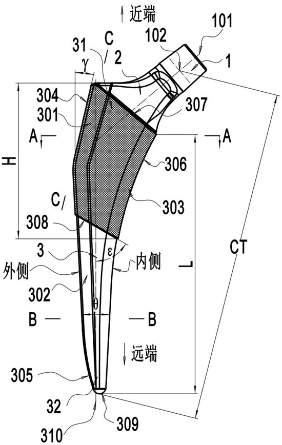 用于髖關節(jié)翻修置換手術的短型股骨柄假體及其制作方法與流程