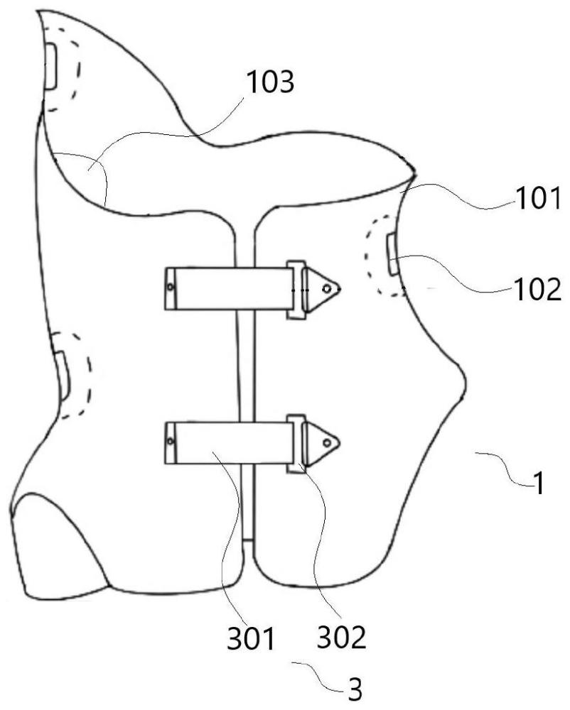 一種壓力可調(diào)節(jié)式脊柱側(cè)彎矯形器