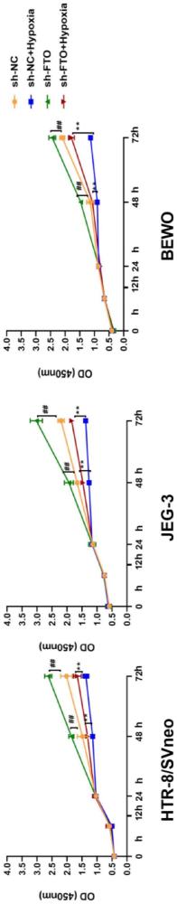 FTO的應(yīng)用、FTO的干擾序列及干擾序列的應(yīng)用