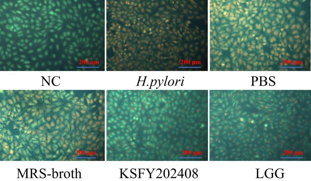 一株植物乳植桿菌KSFY202408及其應(yīng)用的制作方法