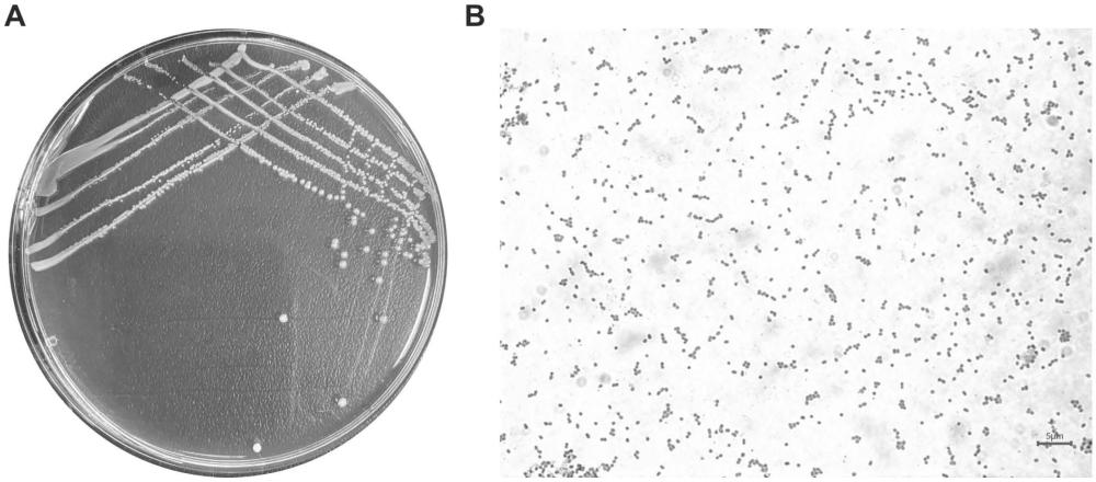 一種產(chǎn)酸克雷伯氏菌Klebsiella oxytoca KN-L及其應(yīng)用