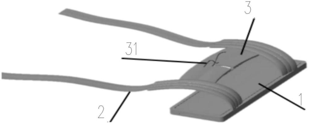 手術(shù)保暖肩托及手術(shù)保暖穿著固定系統(tǒng)的制作方法