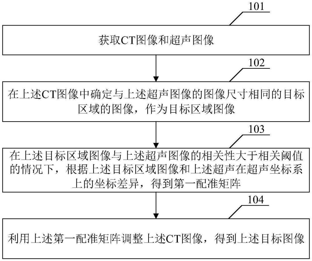 基于圖像配準(zhǔn)的穿刺方法及相關(guān)產(chǎn)品與流程