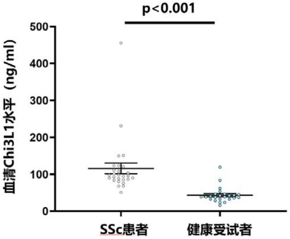 CHI3L1作為靶點在治療系統(tǒng)性硬化癥中的應用