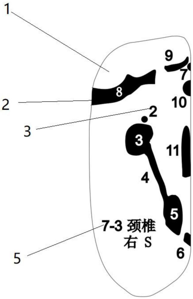 一種理療襪的制作方法