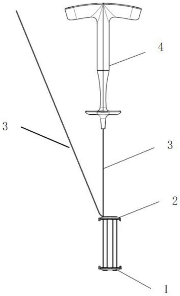 一種顱骨鎖及顱骨鎖組件的制作方法