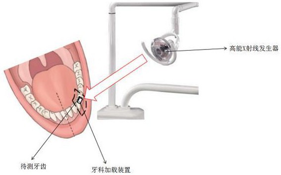 一種基于高能X射線測(cè)量牙槽骨彈性模量的方法及其裝置