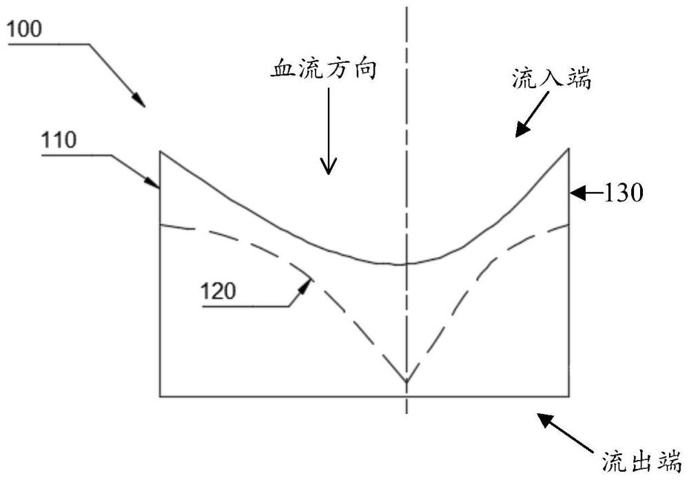 用于瓣膜假體的支架及瓣膜假體的制作方法