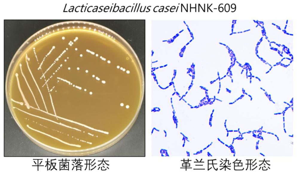 一種干酪乳酪桿菌及其制品和應(yīng)用的制作方法
