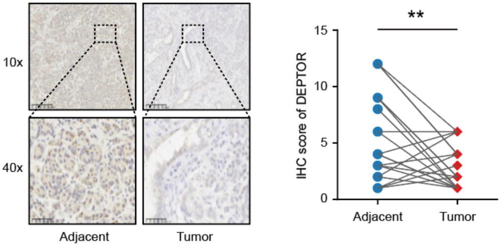 DEPTOR作為生物標(biāo)志物在胰腺癌診斷中的應(yīng)用
