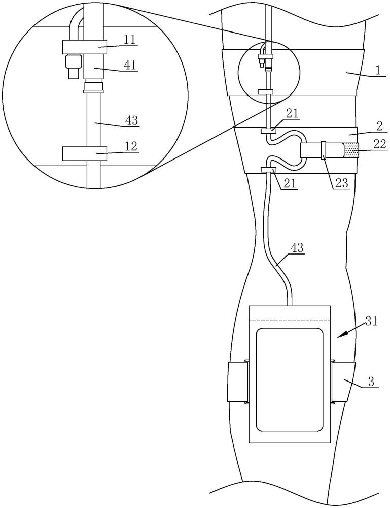 一種導尿管下肢固定器的制作方法