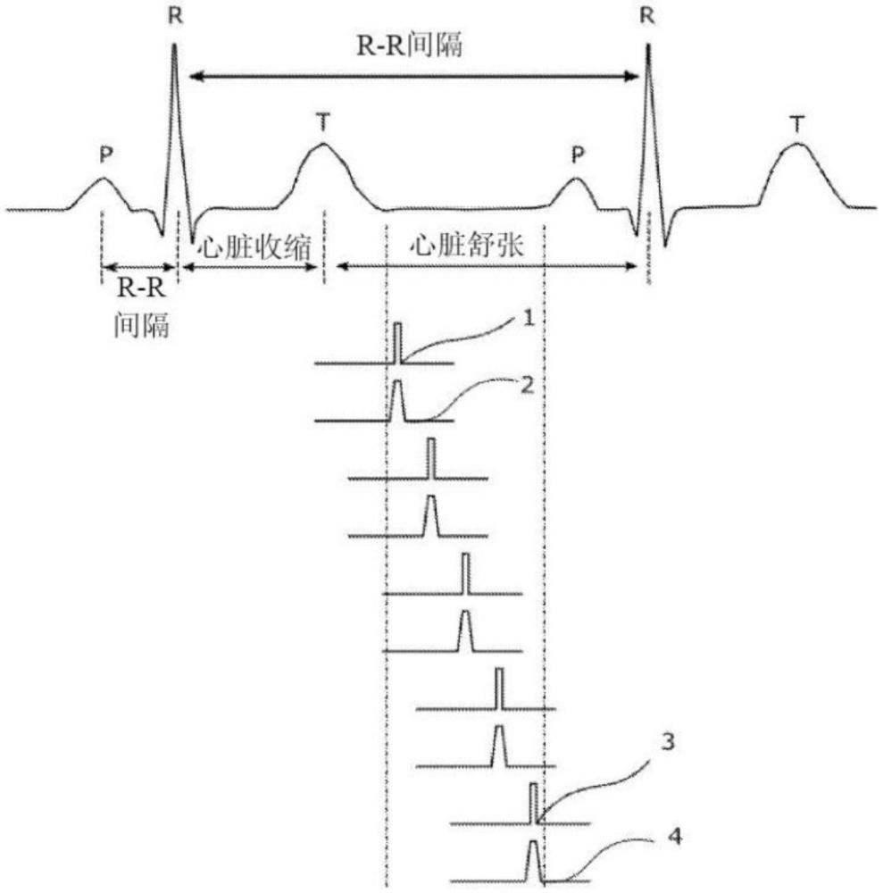 针对多个运动脉冲X射线源断层合成设备使用心电图同步进行图像改善的系统和方法与流程