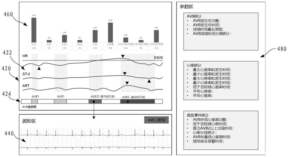 一种医疗设备及心电信号的显示处理方法、存储介质与流程