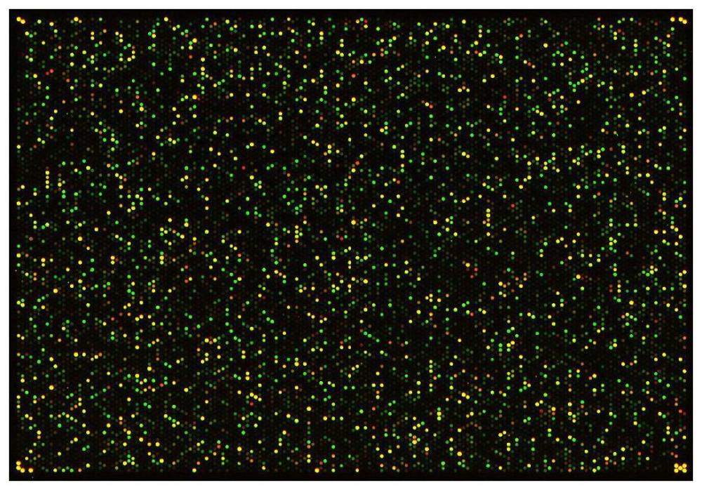 一种检测前列腺癌的生物标志物、试剂盒与应用