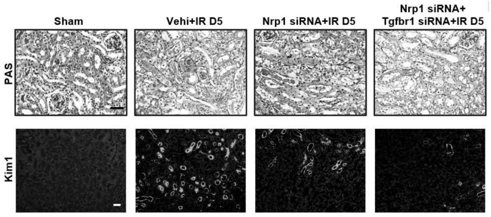 NRP1和TGF-βR抑制剂组合在制备肾损伤治疗药物中的应用