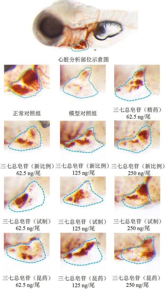 三七总皂苷作为有效成分在制备预防和/或治疗血管内皮损伤性血栓药物中的应用的制作方法