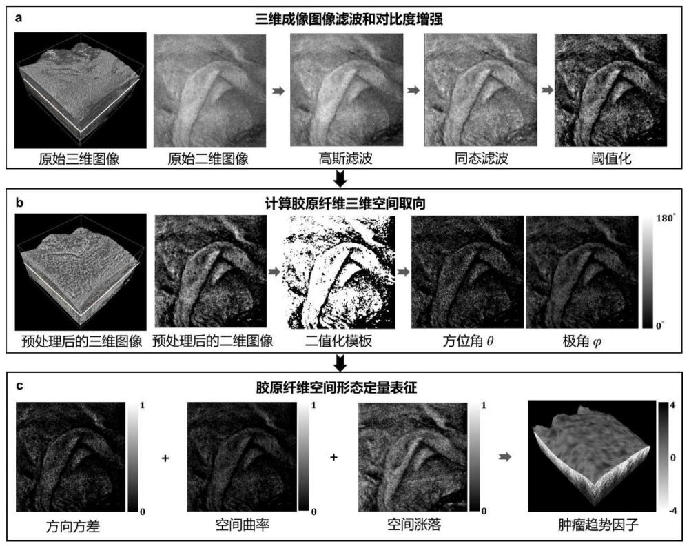 基于光学相干层析成像技术的早期宫颈癌变辅助诊断工具