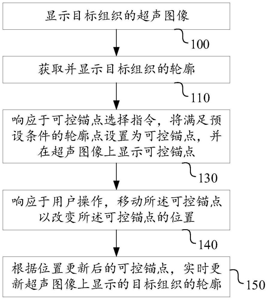 一种基于超声图像的轮廓编辑方法和超声成像系统与流程