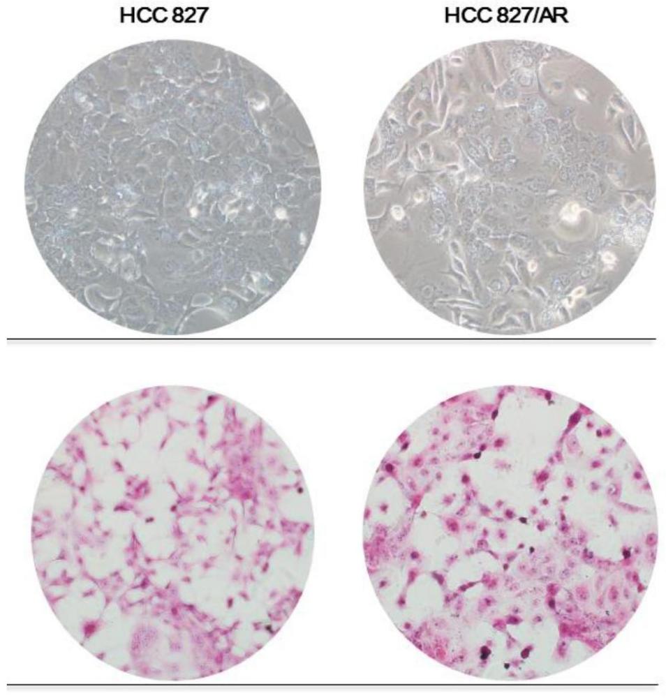 一种耐阿美替尼的非小细胞肺癌细胞株HCC827/AR及其应用