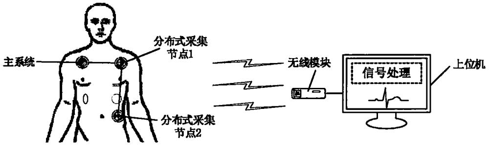 一种多导联菊花链式心电检测系统