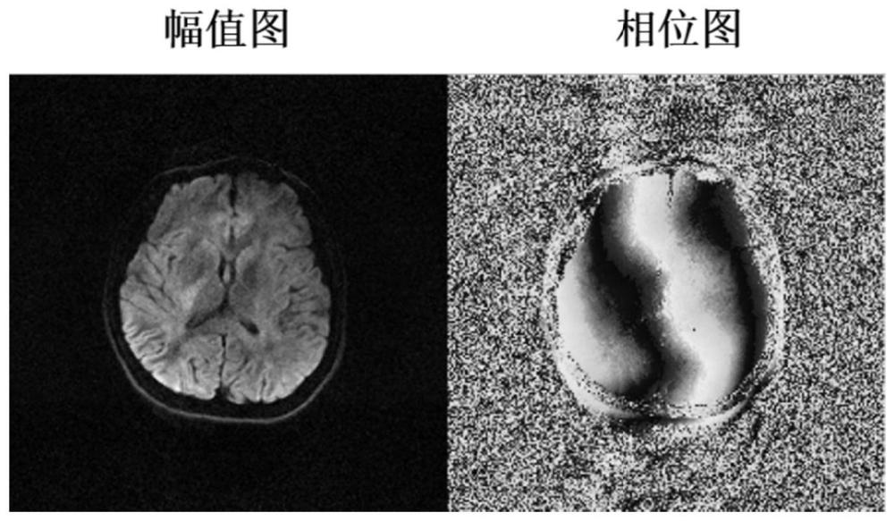 一种高分辨率超高b值扩散磁共振成像方法