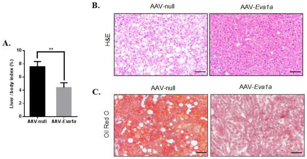 与EVA1A基因相关的生物材料在制备调控肥胖和脂肪肝的药物中的应用