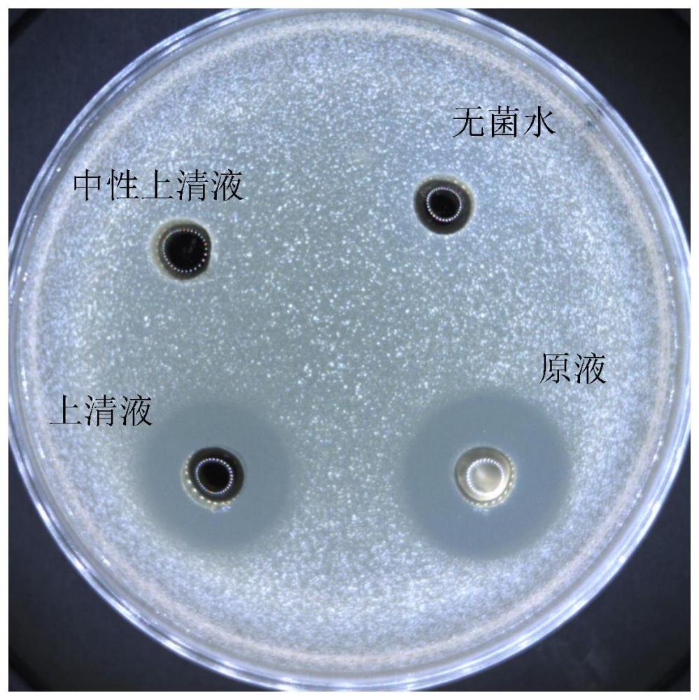 一株戊糖片球菌LWQ1及其应用