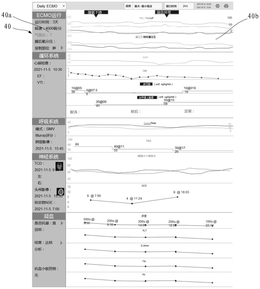 一种医疗设备及其数据显示方法、存储介质与流程