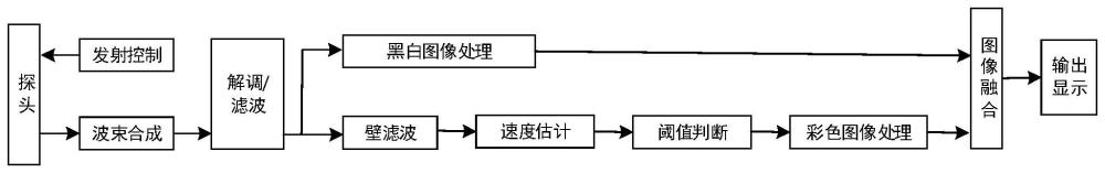 一种超声多普勒血流图像处理方法及相关设备与流程