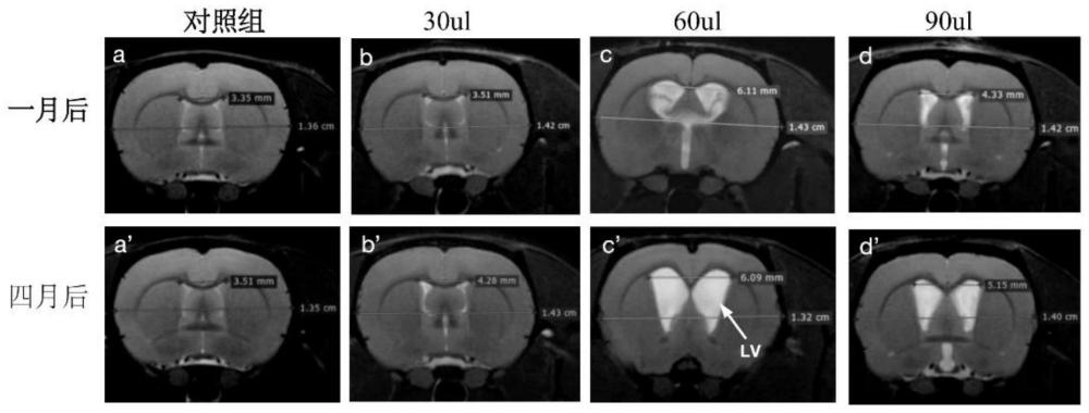 一种脑积水动物实验模型的评估方法