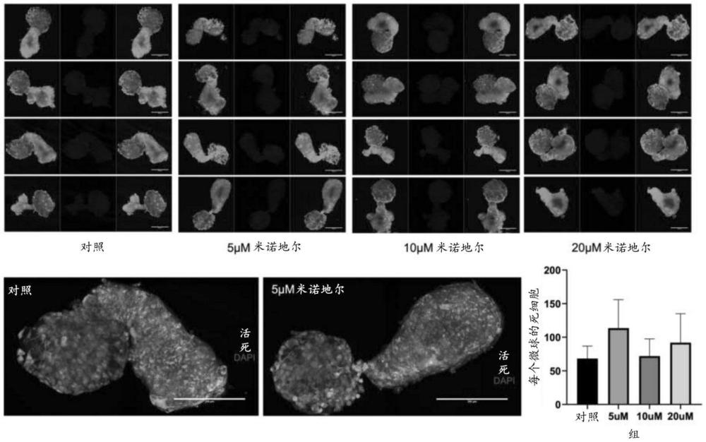 生物工程真皮乳头和毛囊以及相关产品、方法和应用