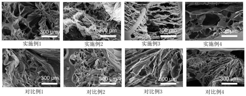 一种两性离子水凝胶在制备糖尿病皮肤修复材料中的应用