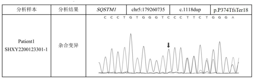 肌萎缩侧索硬化症的SQSTM1的p.P374TfsTer18突变致病基因及其应用