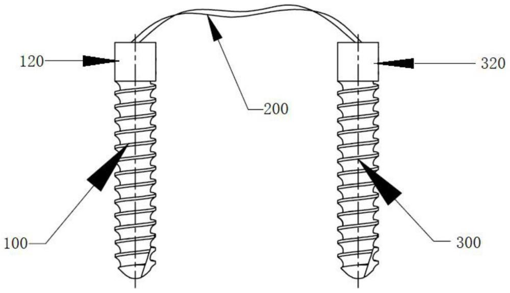 韧带重建系统的制作方法