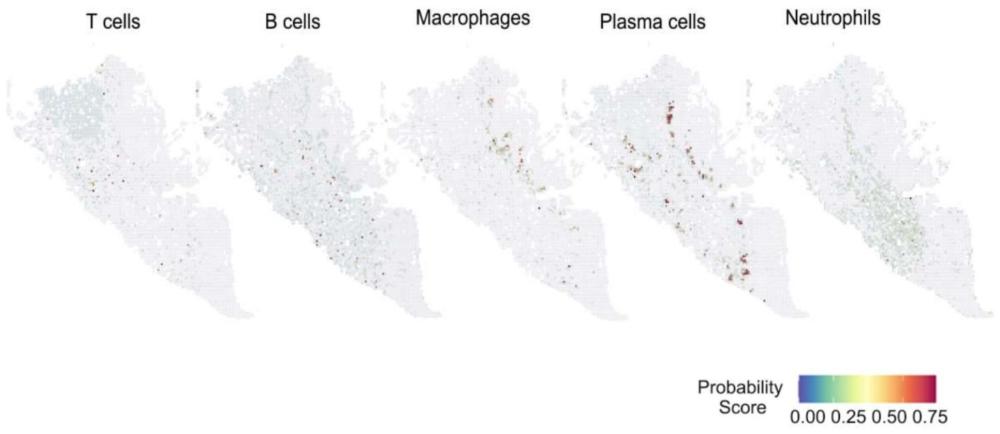 一种基于空间转录组可视化图像评估异常免疫细胞的方法
