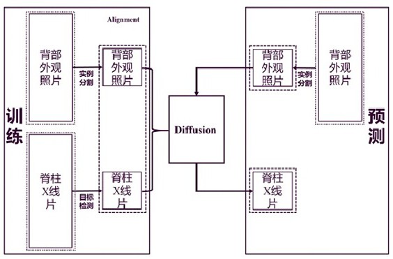 基于稳定扩散模型将背部照片转换成脊柱X光影像的方法