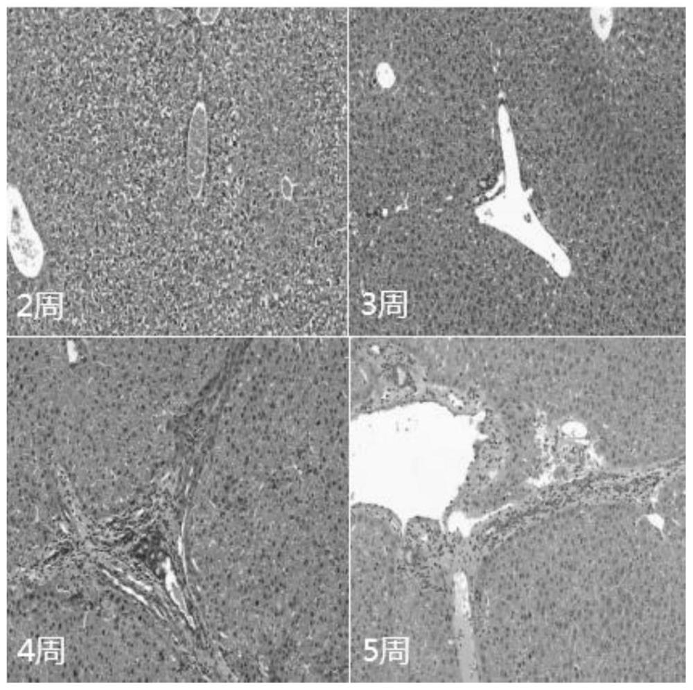 一种慢性HBV病毒复制伴肝炎症损伤小鼠模型的构建及应用