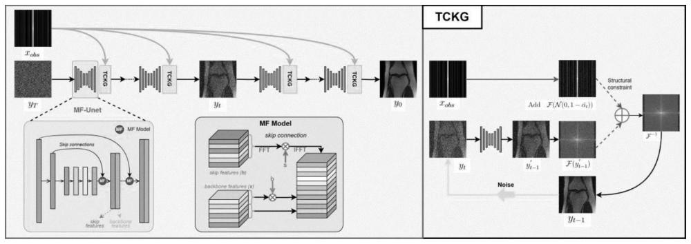 一种基于TC-DiffRecon模型的纹理协调的MRI图像重建方法
