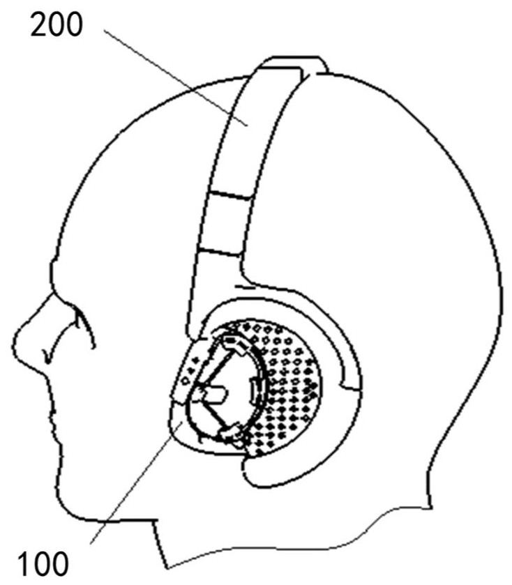 一种耳廓保持器的制作方法