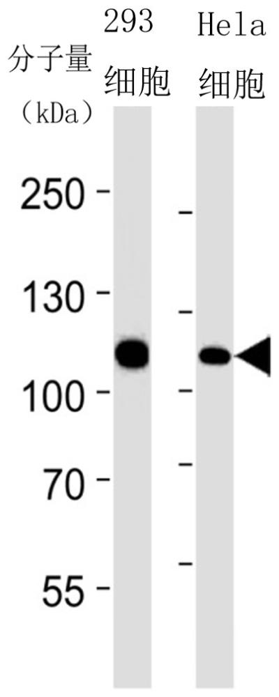 一种抗MSH2重组兔单克隆抗体及其应用的制作方法